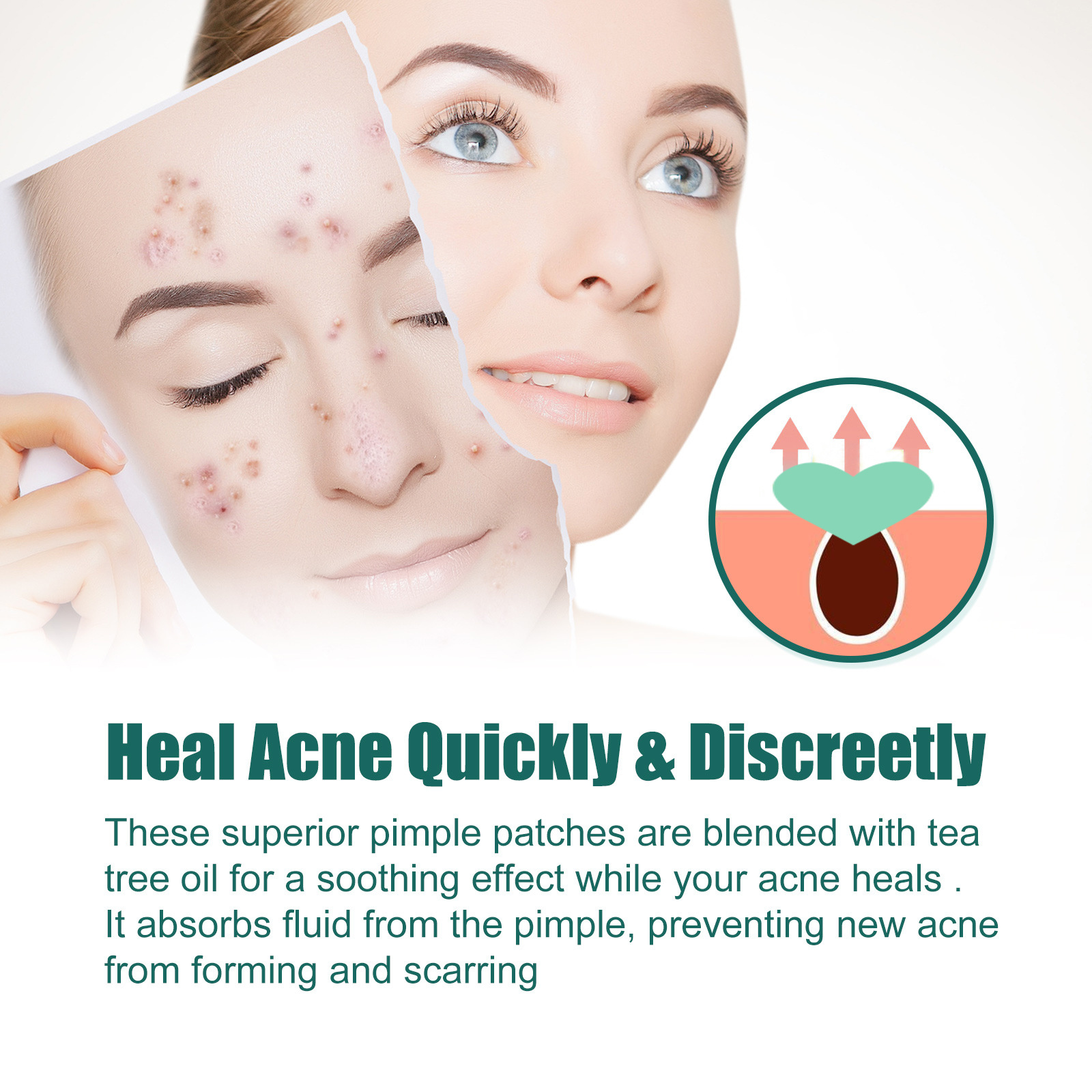 EELHOE Love Acne Patch Gentle Cleansing Acne Patch Fades Facial Acne Marks And Spots Facial Cleansing Care - Image 2